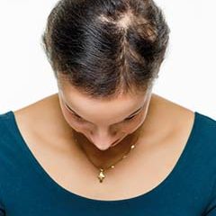 Haarverdichtung ohne Schnitt vorher